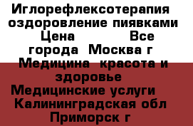 Иглорефлексотерапия, оздоровление пиявками › Цена ­ 3 000 - Все города, Москва г. Медицина, красота и здоровье » Медицинские услуги   . Калининградская обл.,Приморск г.